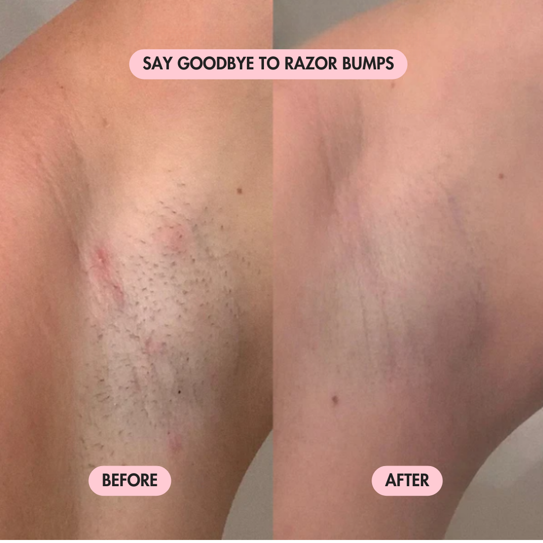 Glaceva 2-in-1 Bikini Trimmer